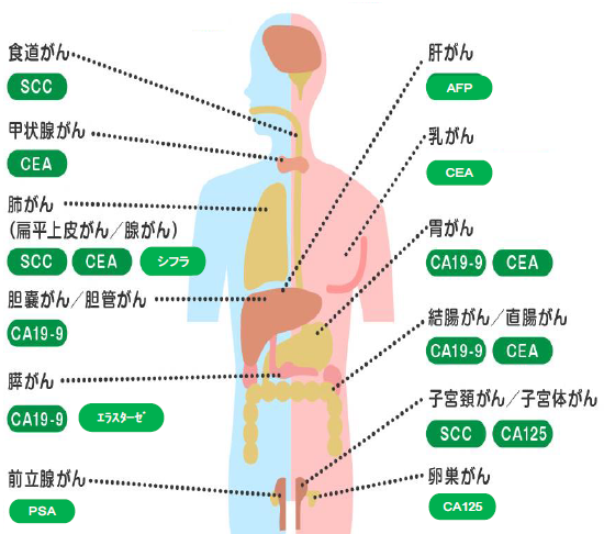 腫瘍マーカー検査２