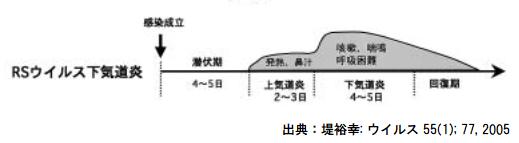 RSウイルス感染症の症状の経過